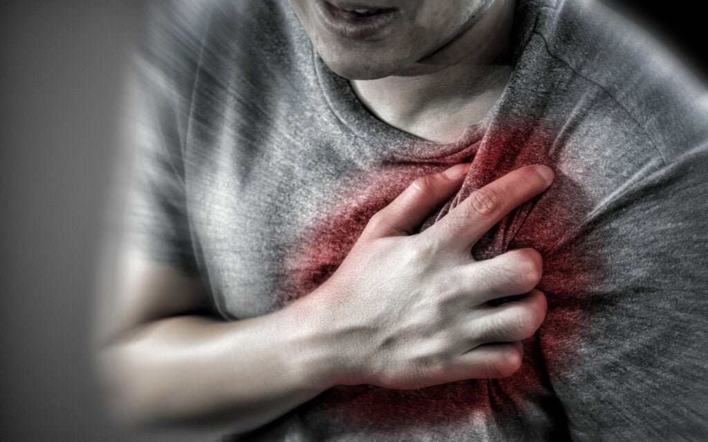 Heart Attack
